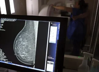Plano de saúde terá que cobrir mamografia digital para todas as idades