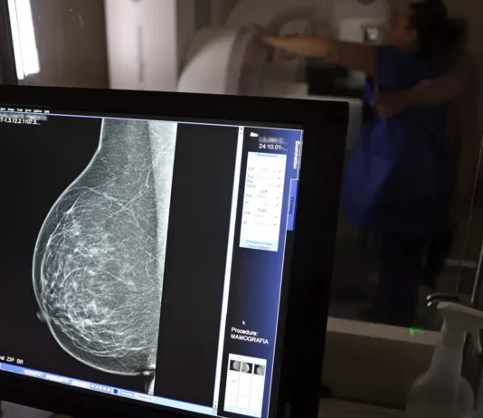 Plano de saúde terá que cobrir mamografia digital para todas as idades